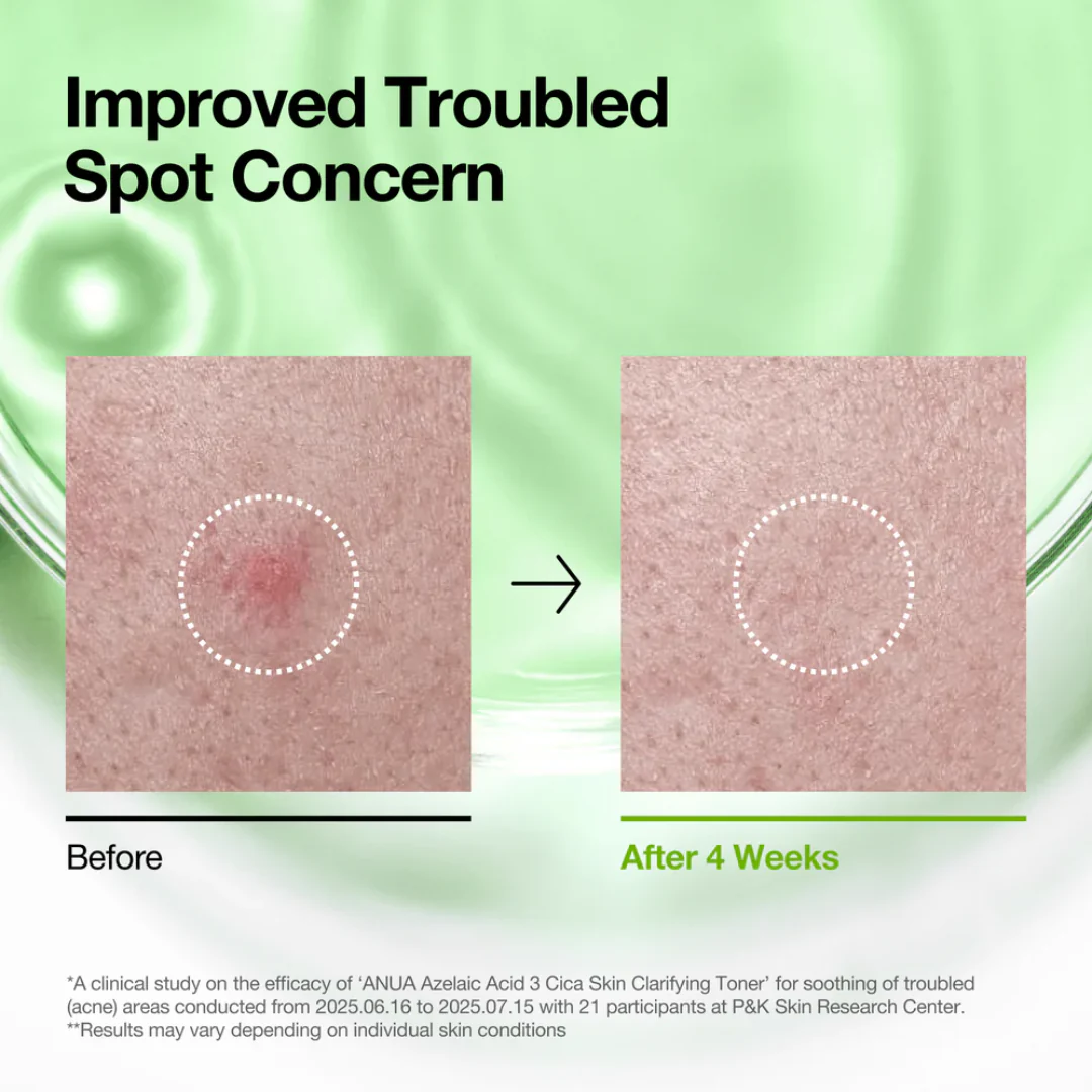 Anua Azelaic Acid 3 Cica Skin Clarifying Toner - Image 3