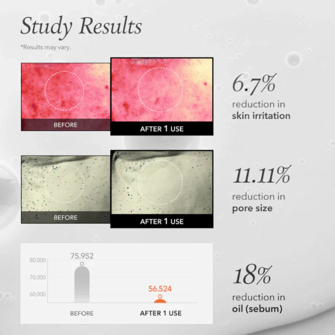 APRILSKIN Carrotene IPMPâ„¢ Instant Calming Serum Pads - Image 6