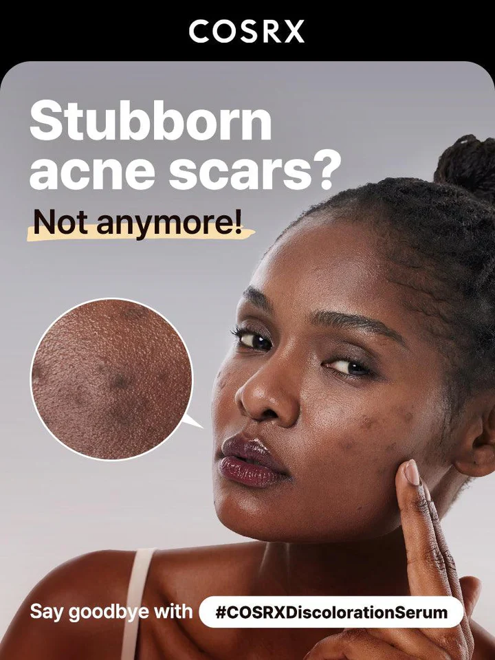 COSRX The Alpha-Arbutin 2 Discoloration Care Serum - Image 3