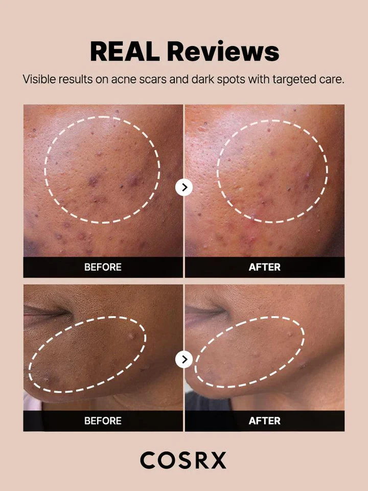 COSRX The Alpha-Arbutin 2 Discoloration Care Serum - Image 5
