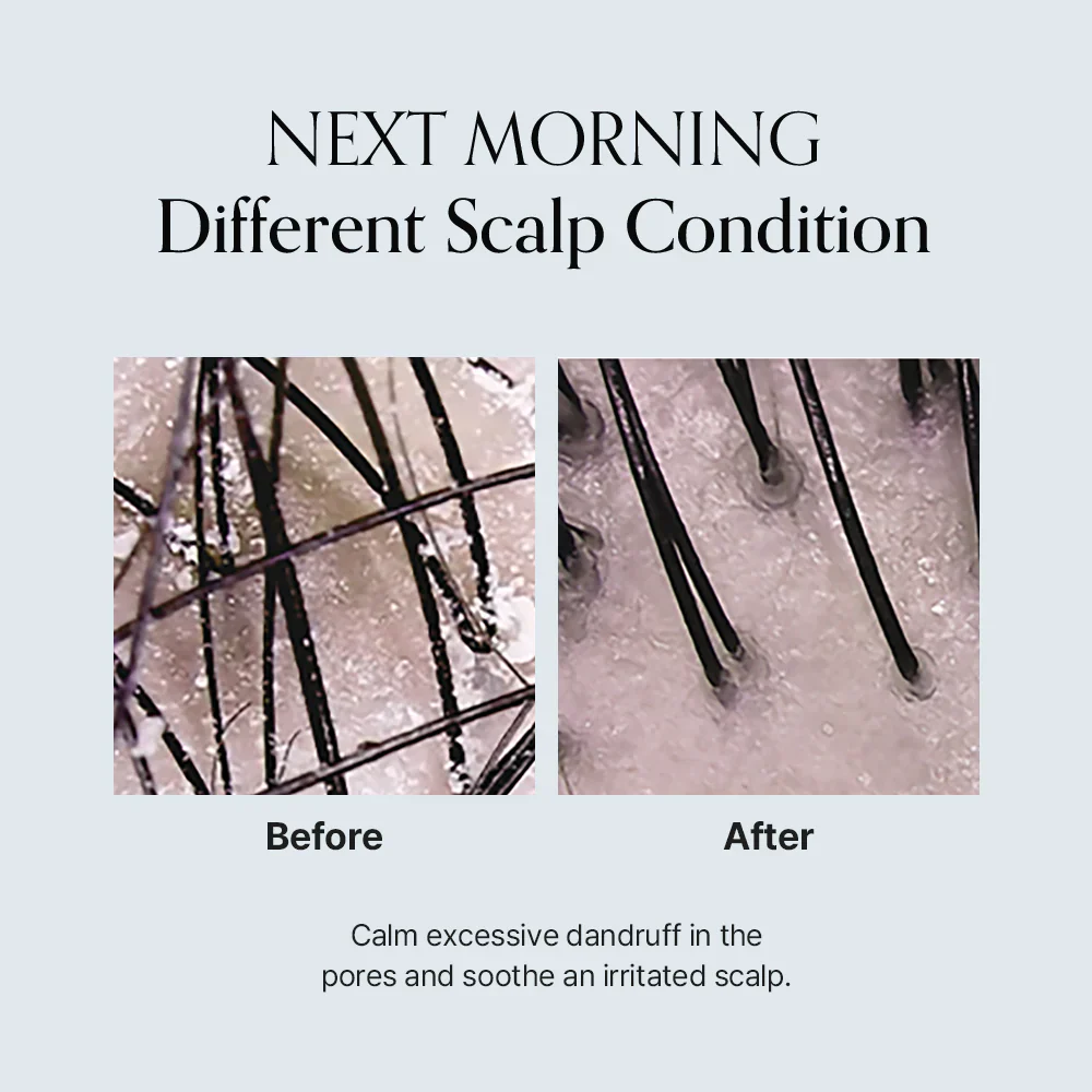 GROWUS Damage Therapy Scalp Scaling Ampoule - Image 6