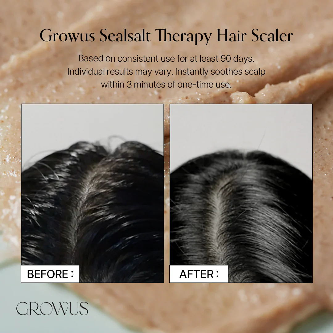 GROWUS Sea Salt Therapy Scalp Scaler - Image 4