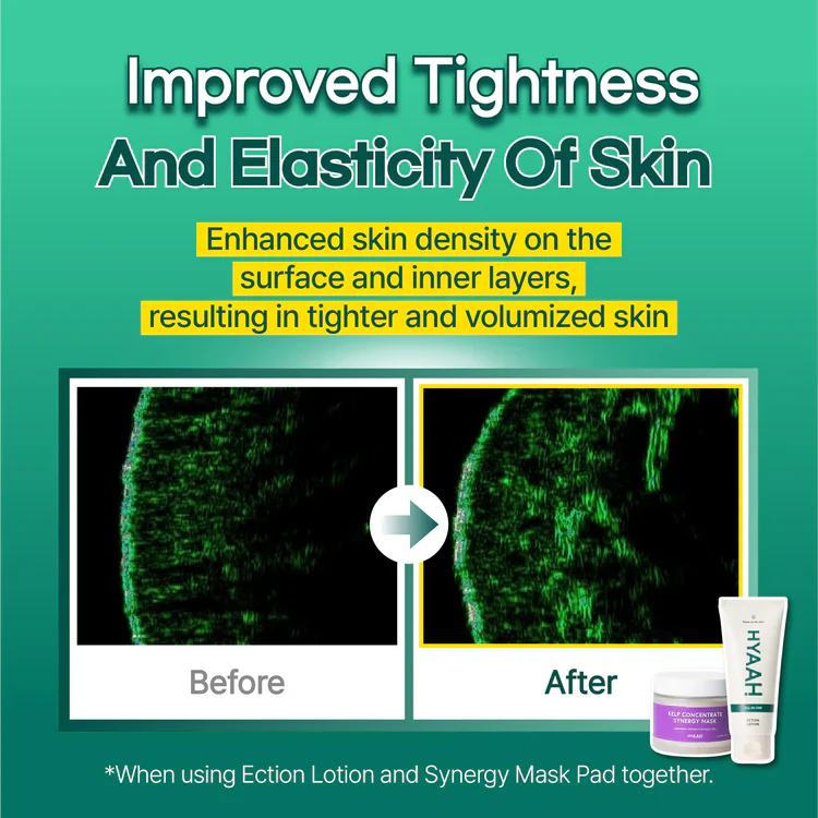 HYAAH All-in-One Ectoin Lotion - Image 10