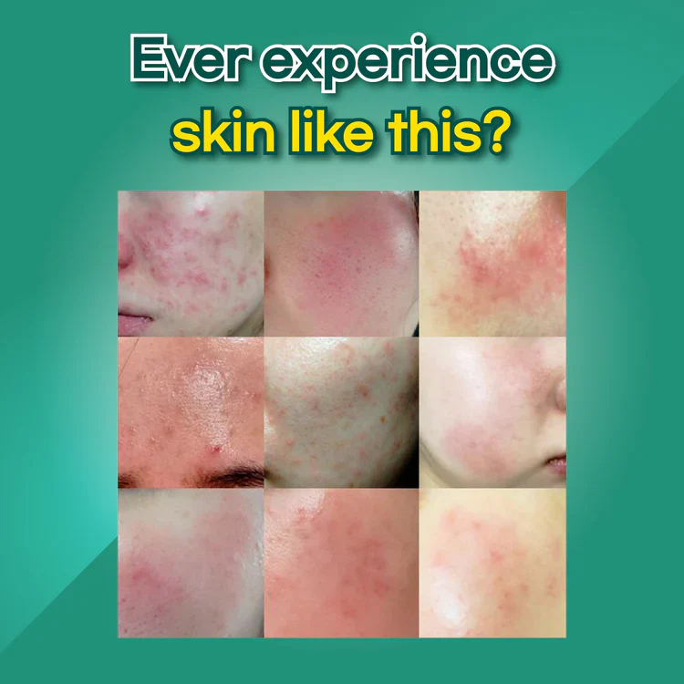 HYAAH All-in-One Ectoin Lotion - Image 5