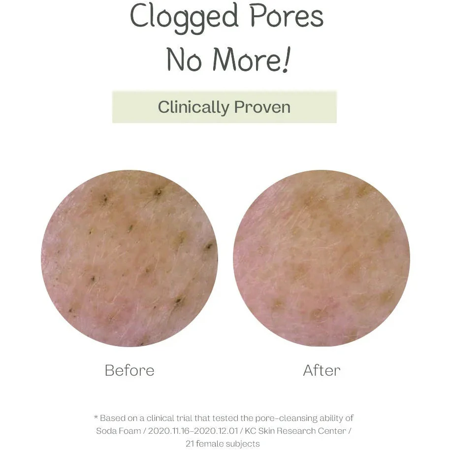 ma:nyo Deep Pore Cleansing Soda Foam - Image 4