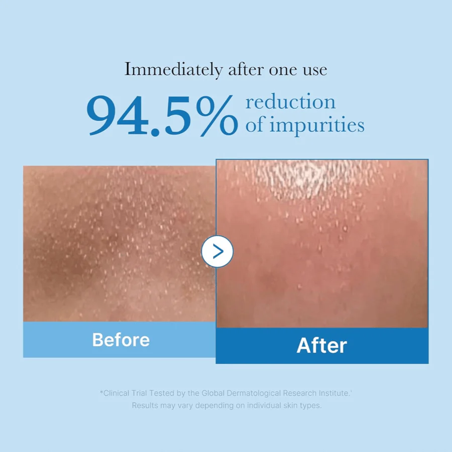 Medicube Pore Black Deep Cleansing Oil - Image 4