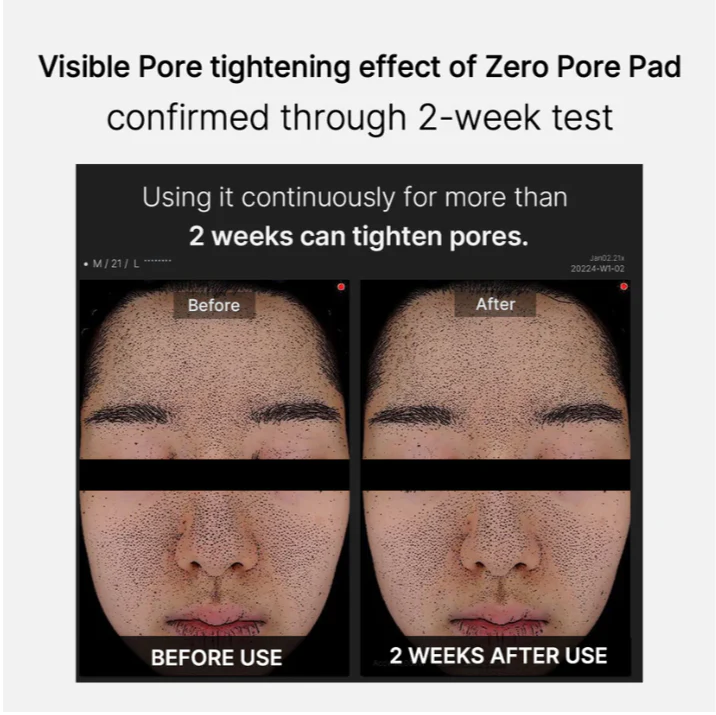 Medicube Zero Pore Pad - Image 4