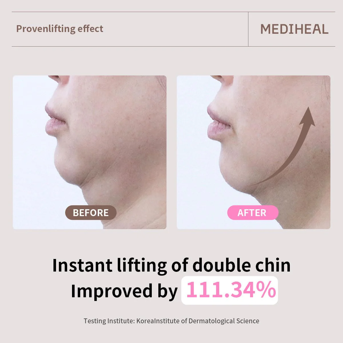 Mediheal Retinol Collagen Ampoule Lifting Mask - Image 2