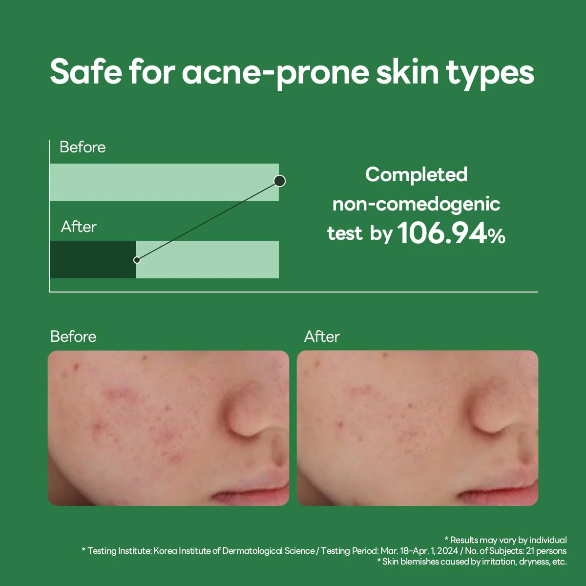 Mediheal Teatree Calming Hydra Serum - Image 3