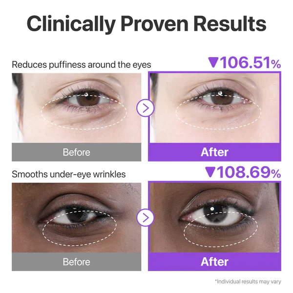 Numbuzin No.9 NAD Collagen Under Eye Patches - Image 9