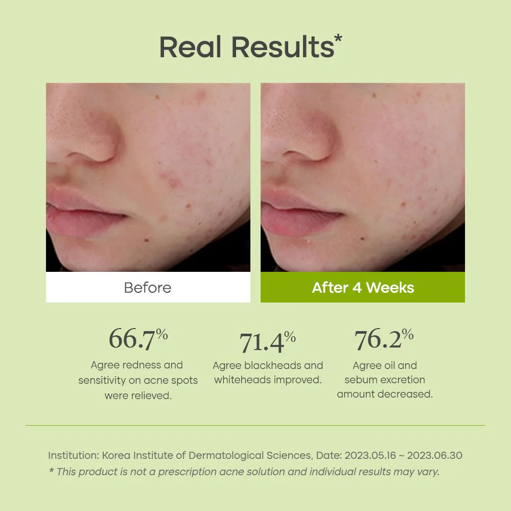 Purito Clear Code Superfruit Serum - Image 4