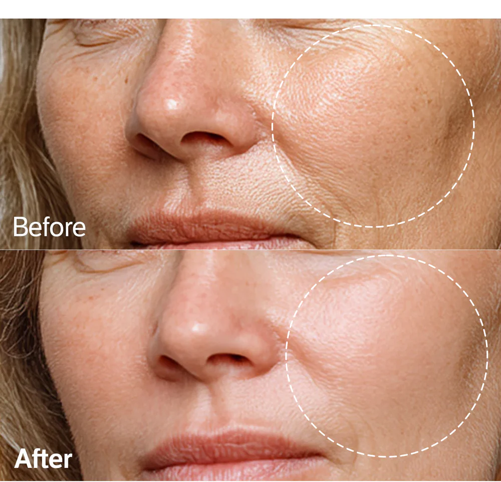 Sungboon Editor Deep Collagen Barrier Serum Mist - Image 5