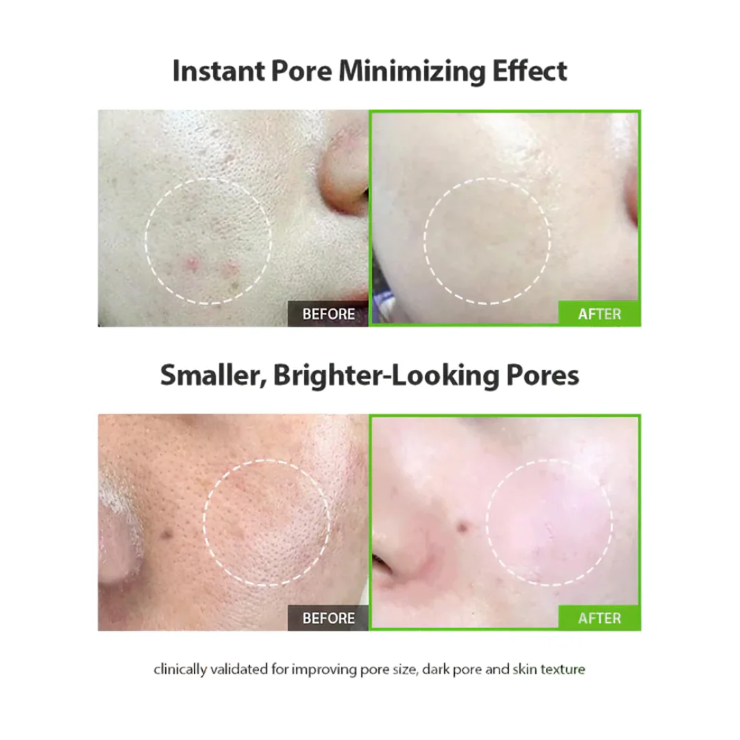 Sungboon Green Tomato Pore Lifting Ampoule+ - Image 3