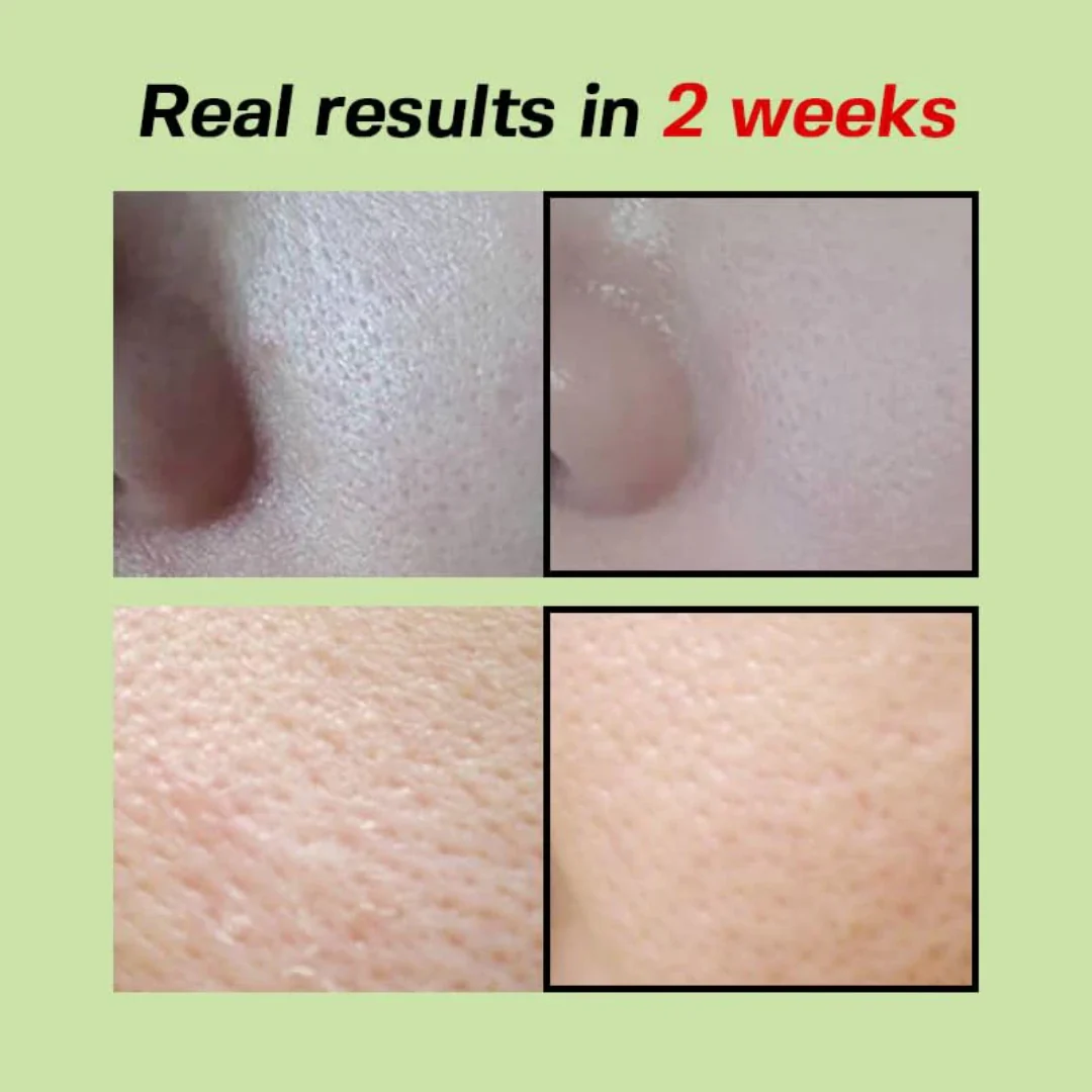 Sungboon Green Tomato Pore Lifting Ampoule+ - Image 7