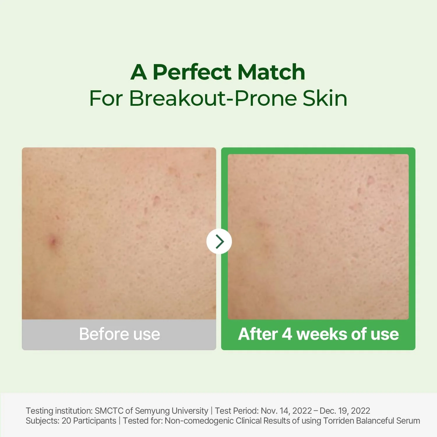 Torriden Balanceful Cica Serum - Image 4