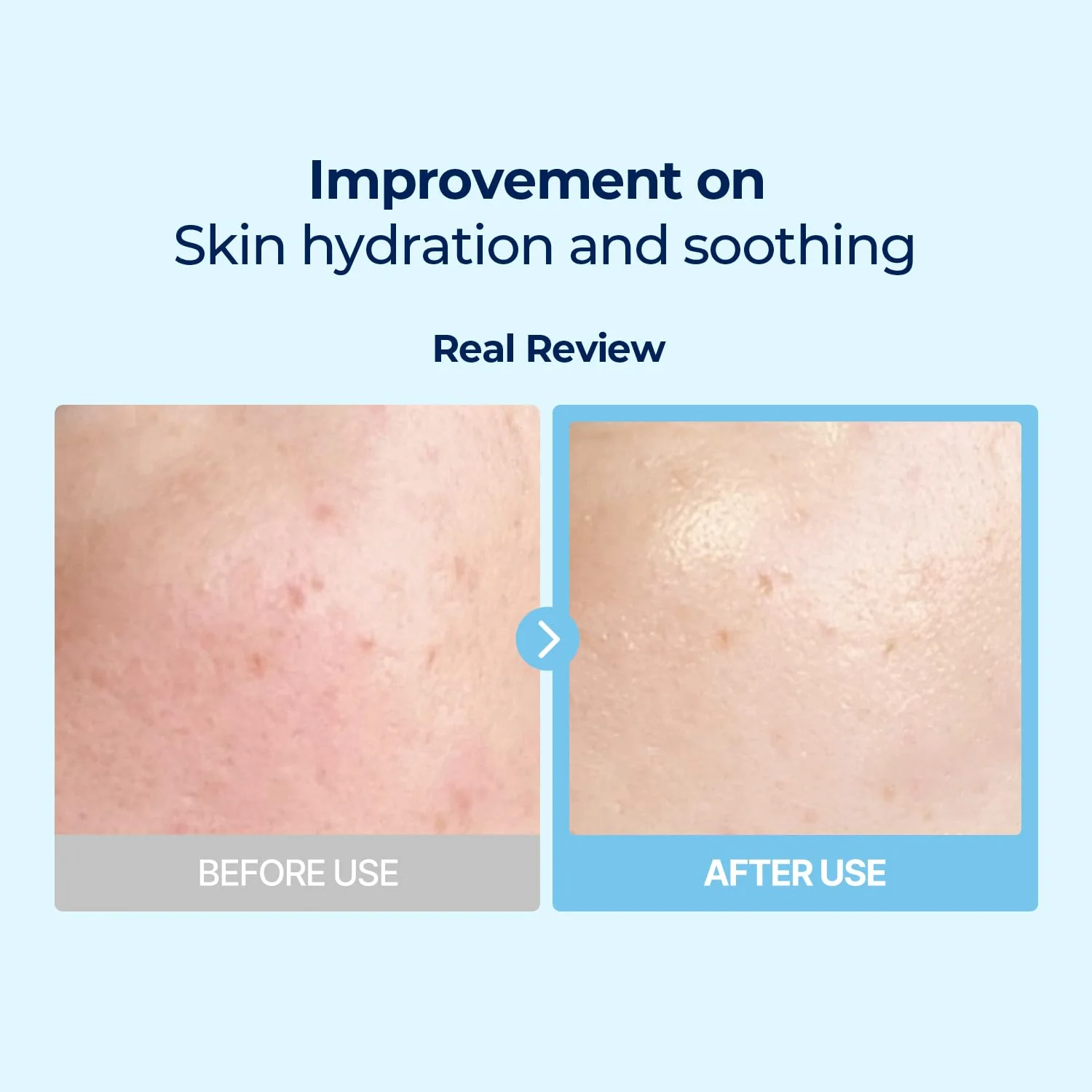 Torriden Dive In Low Molecule Hyaluronic Acid Multi Pad - Image 3